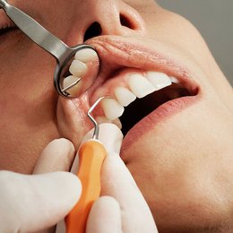 Ein Zahnarzt führt eine professionelle Zahnreinigung durch.